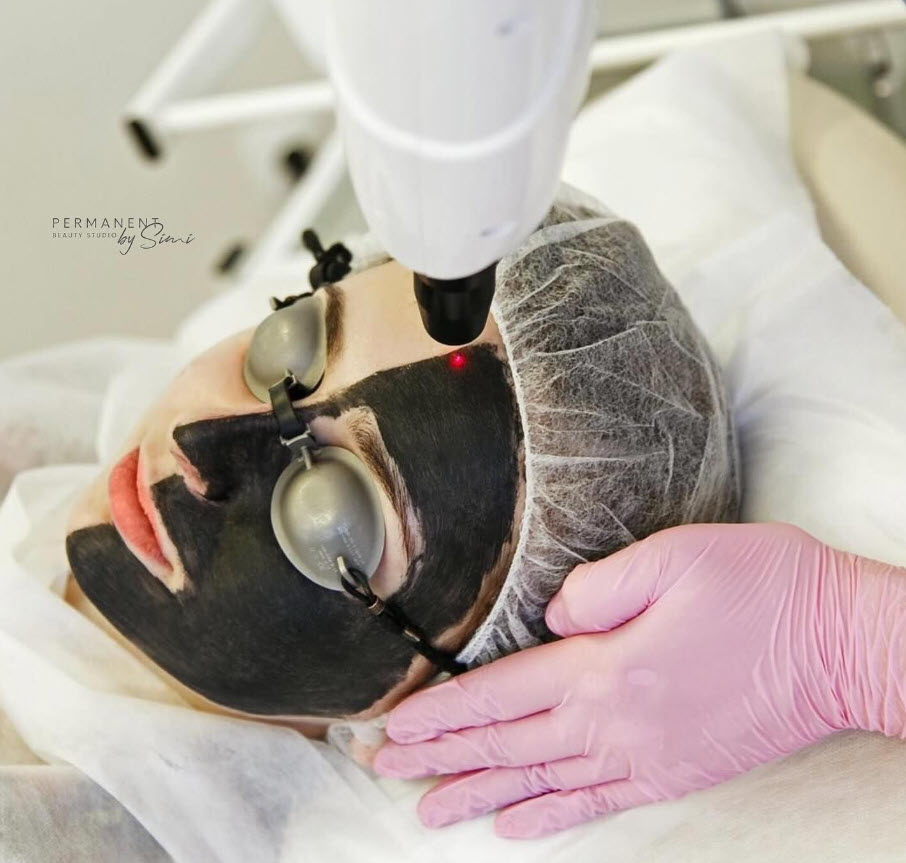 Hollywood Carbon Peel - permanent by simi