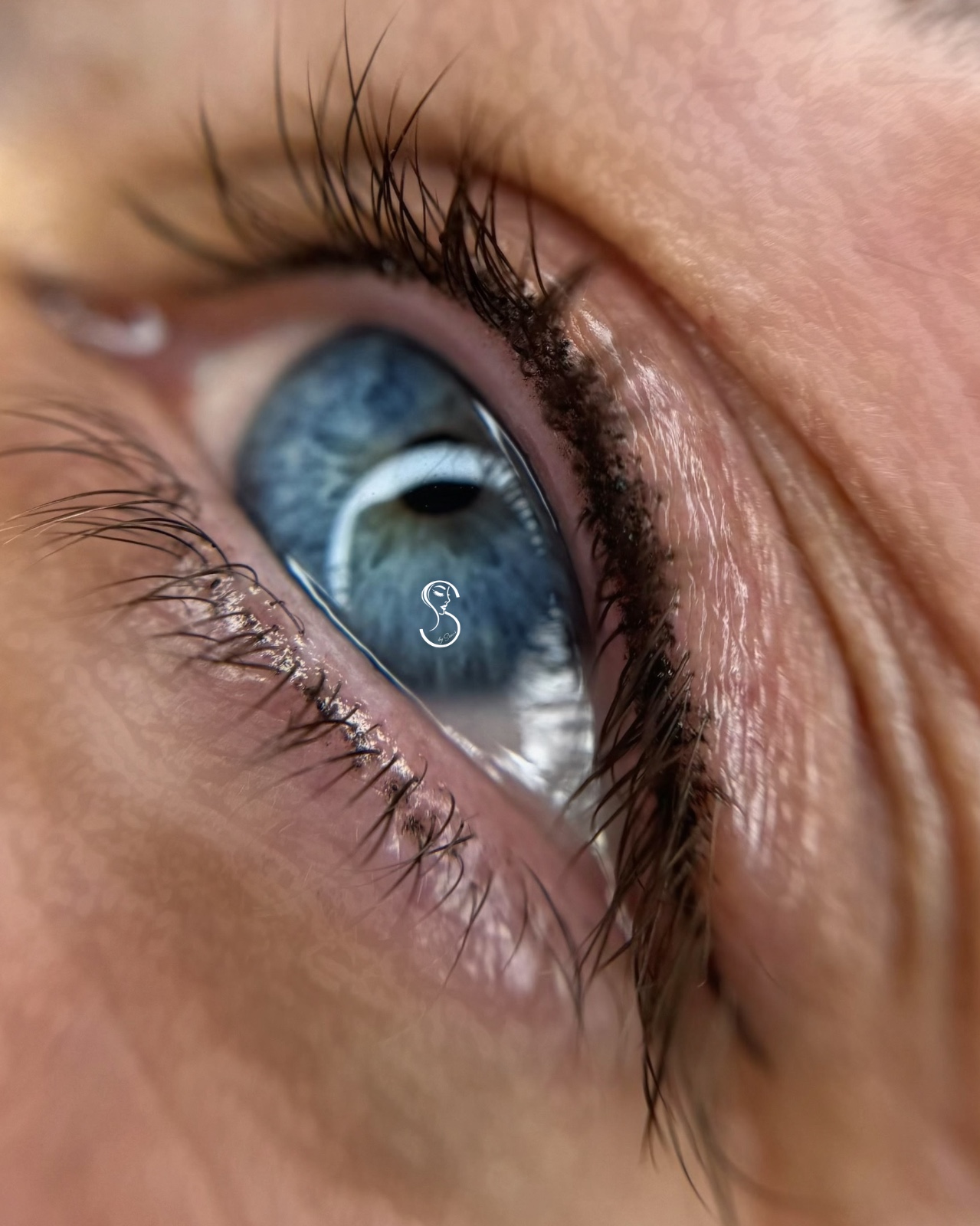 Medziriasová očná linka